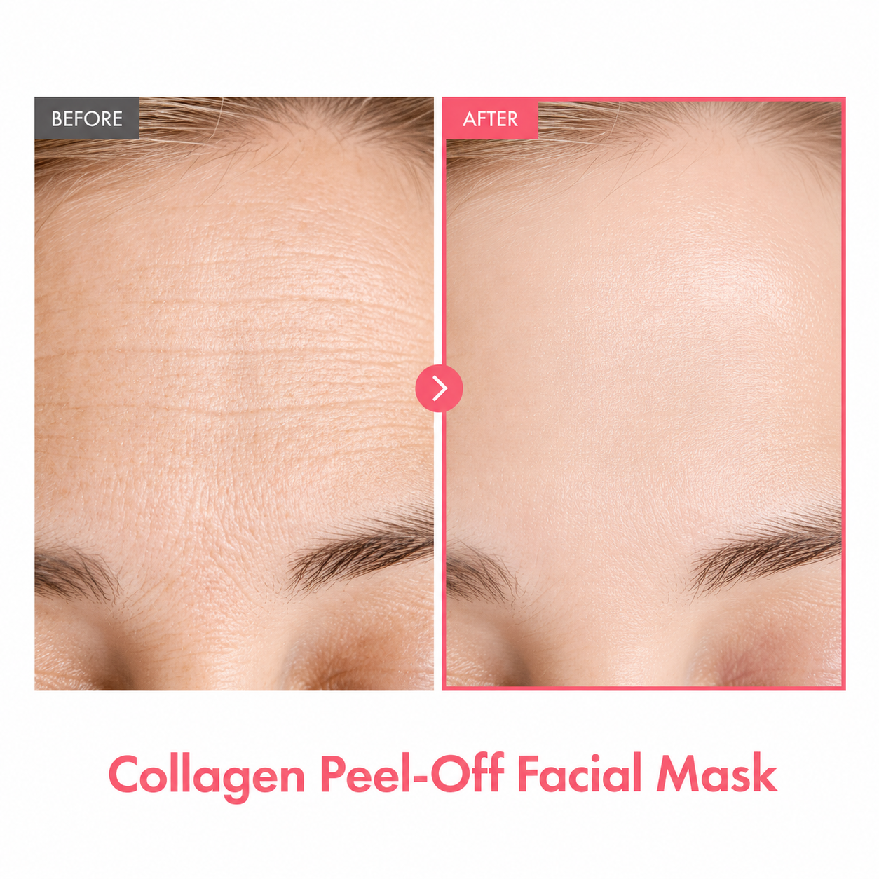 TOSOWOONG Real Collagen Fit, มาส์กห่อหุ้มคอลลาเจนไฮโดรไลซ์, 50ml, 1.69 fl. oz.