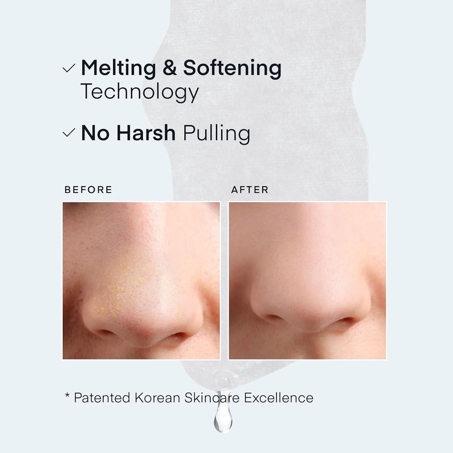 Terez & Honor 블랙헤드 제거용 코 모공 패치 5개