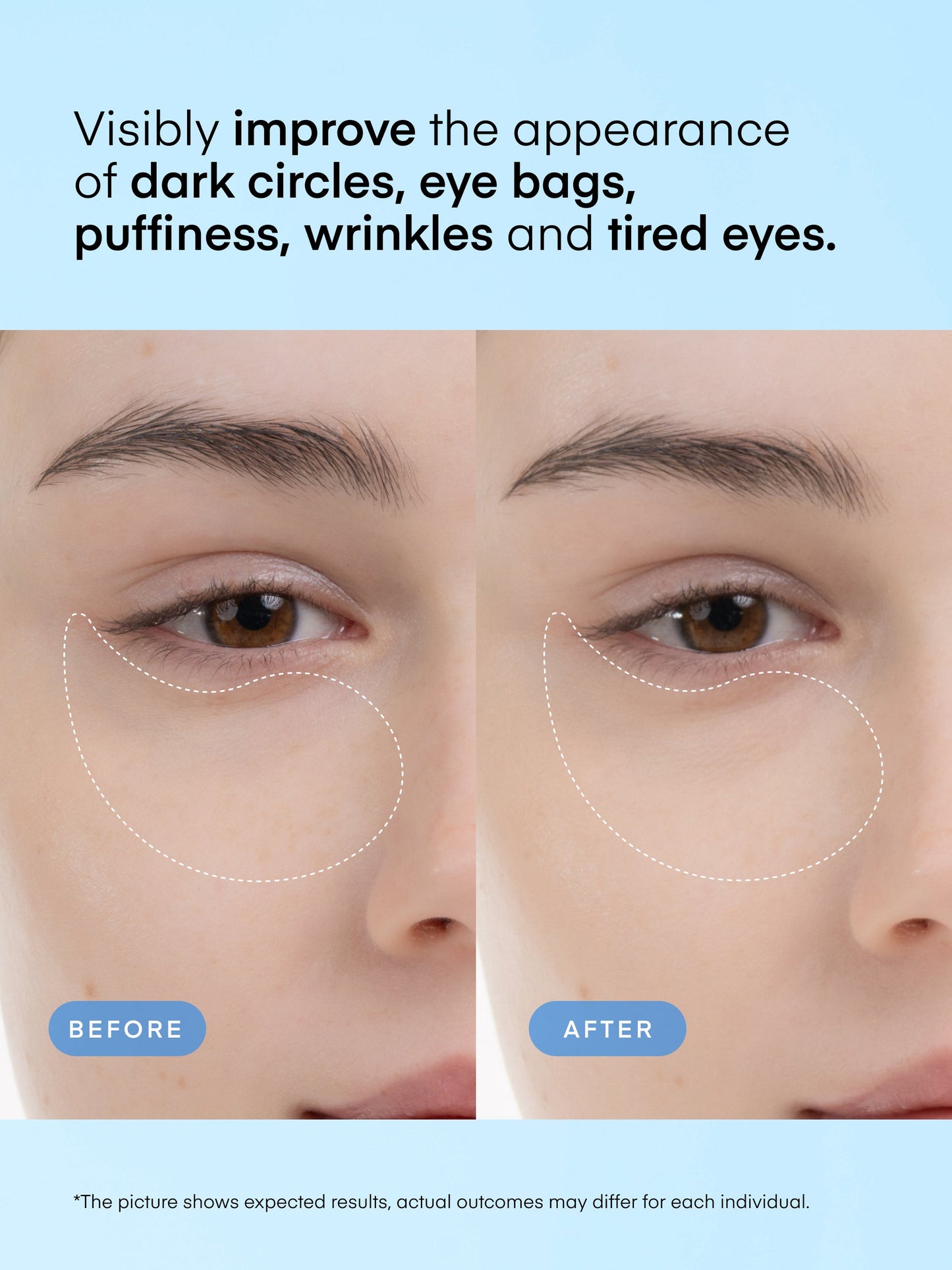 Terez & Honor Caffeine Eye Patches Go-Packs