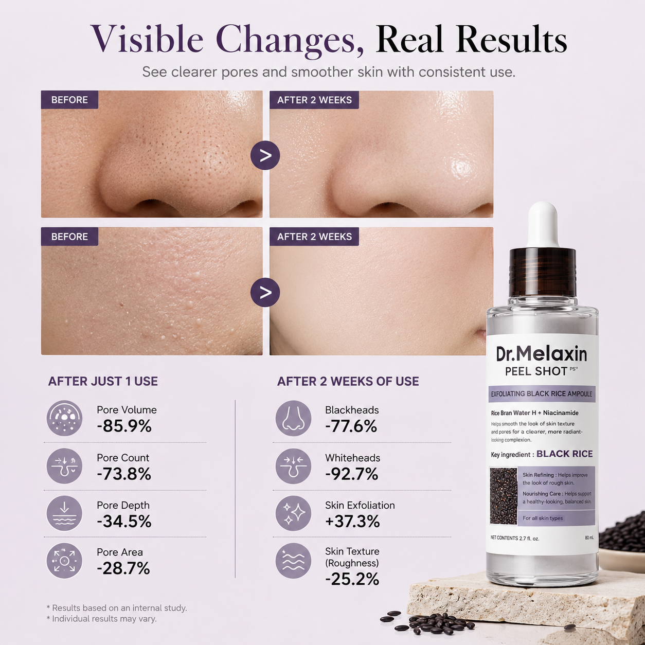 Dr.Melaxin Peel Shot Glow Itim na Bigas Peeling Ampoule 80ml
